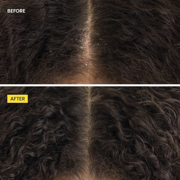 Crown Tonic Scalp-Balancing Jumbo Set