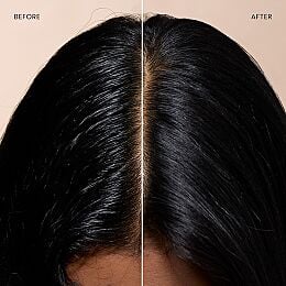 Before-and-after scalp comparison showing reduced visible oil and a refreshed appearance after using Drybar Detox Silk Dry Shampoo.